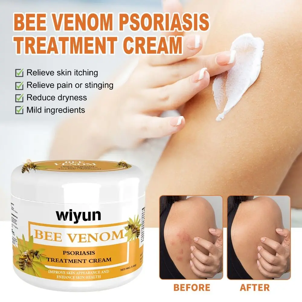 Repair Hands and Feet Skin Moss Bee Venom Psoriasis Cream Smooth Moisturizing Bee Venom Cowhide Moss Cream Red Itchy Skin Care