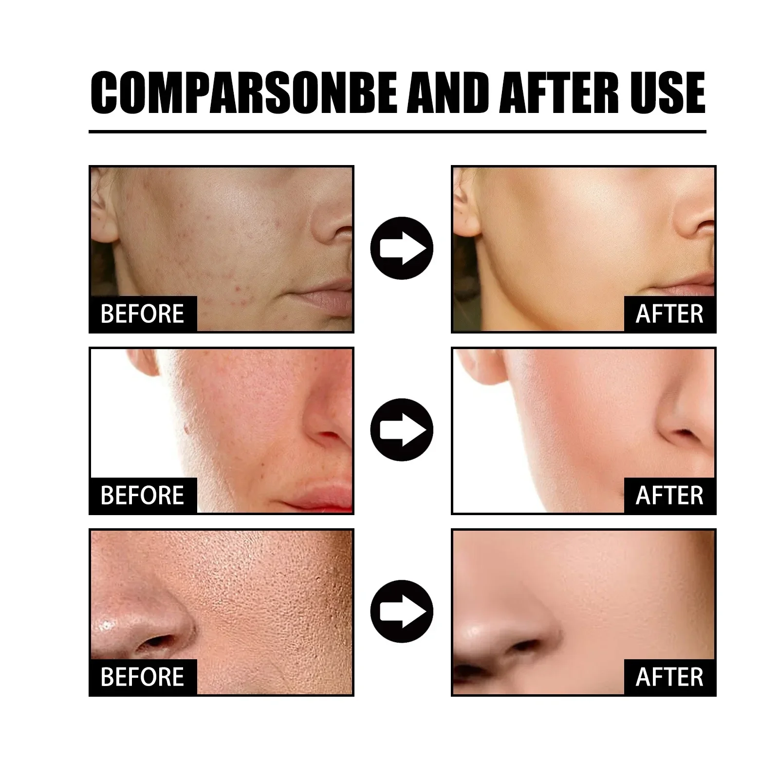 Niacinamide Serum for Acne and Dark Spots - Hyaluronic Acid Anti Aging Face Serum Pore Shrinking Hydrating Moisturizing 50ml 5