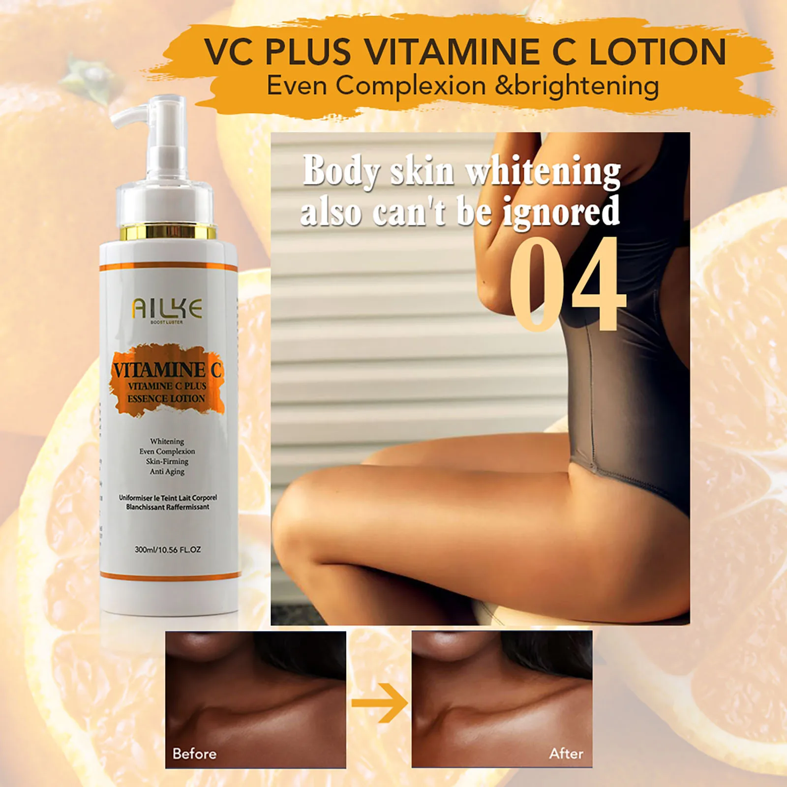 Effective Whiten Freckle Cream, Remove Dark Spot, Melasma, Fade Melanin, Anti-pigmentation, Improve Dullness, Fast Brighten 4
