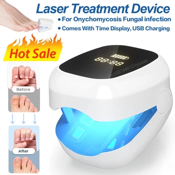 Dispositivo laser a LED per il trattamento dei funghi delle unghie per la pulizia dell'onicomicosi Carica USB 905nm Luce infrarossa 470nm Luce blu per salone di bellezza