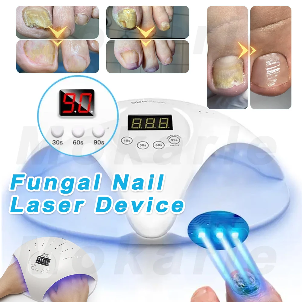 2-In-1 Fungal Nail Laser Device Repair Fast Nails Fungus Onychomycosis Repair Toenail Fingernail Removes Nail Fungus Foot Care nail fungus remover