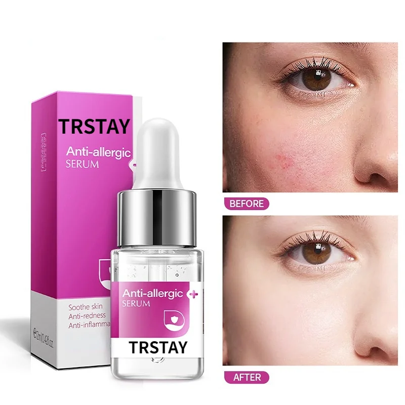 

Антиаллергическая сыворотка, увлажняющая ортопедическая кожа, удаляет покраснения, противовоспалительное масло, средство для ухода за кожей лица