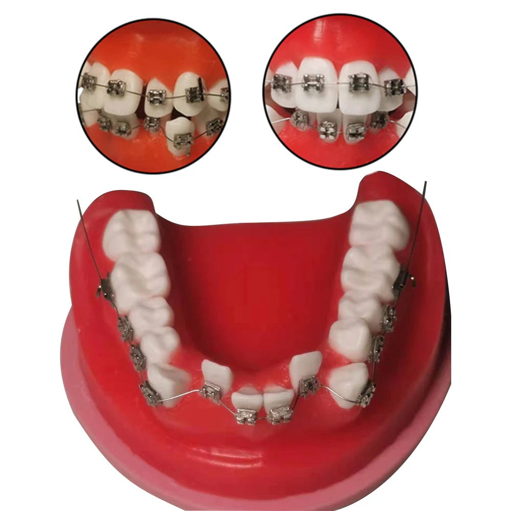 Dental Orthodontic Model Typodont Teeth Model For Dental Technician