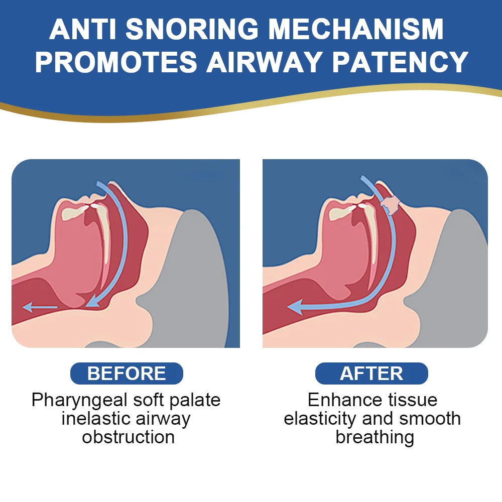 10/30/50/100Pcs Nasal Strips Relieve Rhinitis Nose Congestion Anti Snoring Plaster Sleep Aid Sticker Easier Breath Health Patch