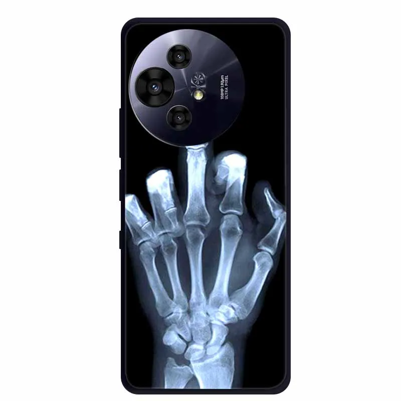 Premium Black Silicone Protective Case for TCL 50 Pro NxtPaper 5G