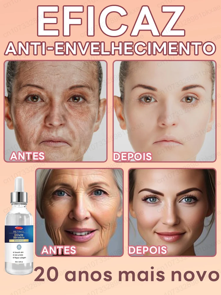 Wrinkles disappear, the first choice for women who love beauty 2