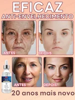 wrinkles disappear become beautiful now 2