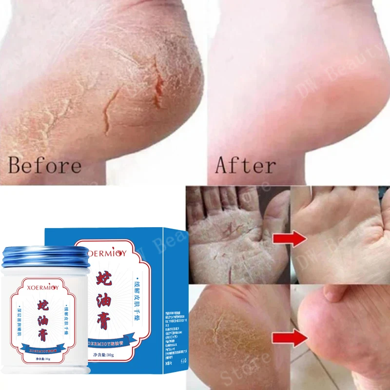 

Herbal Anti Crack Foot Cream Heel Cracking Repairing Products Removal Beriberi Dead Skin Softening Moisturizing Smooth Care 30g