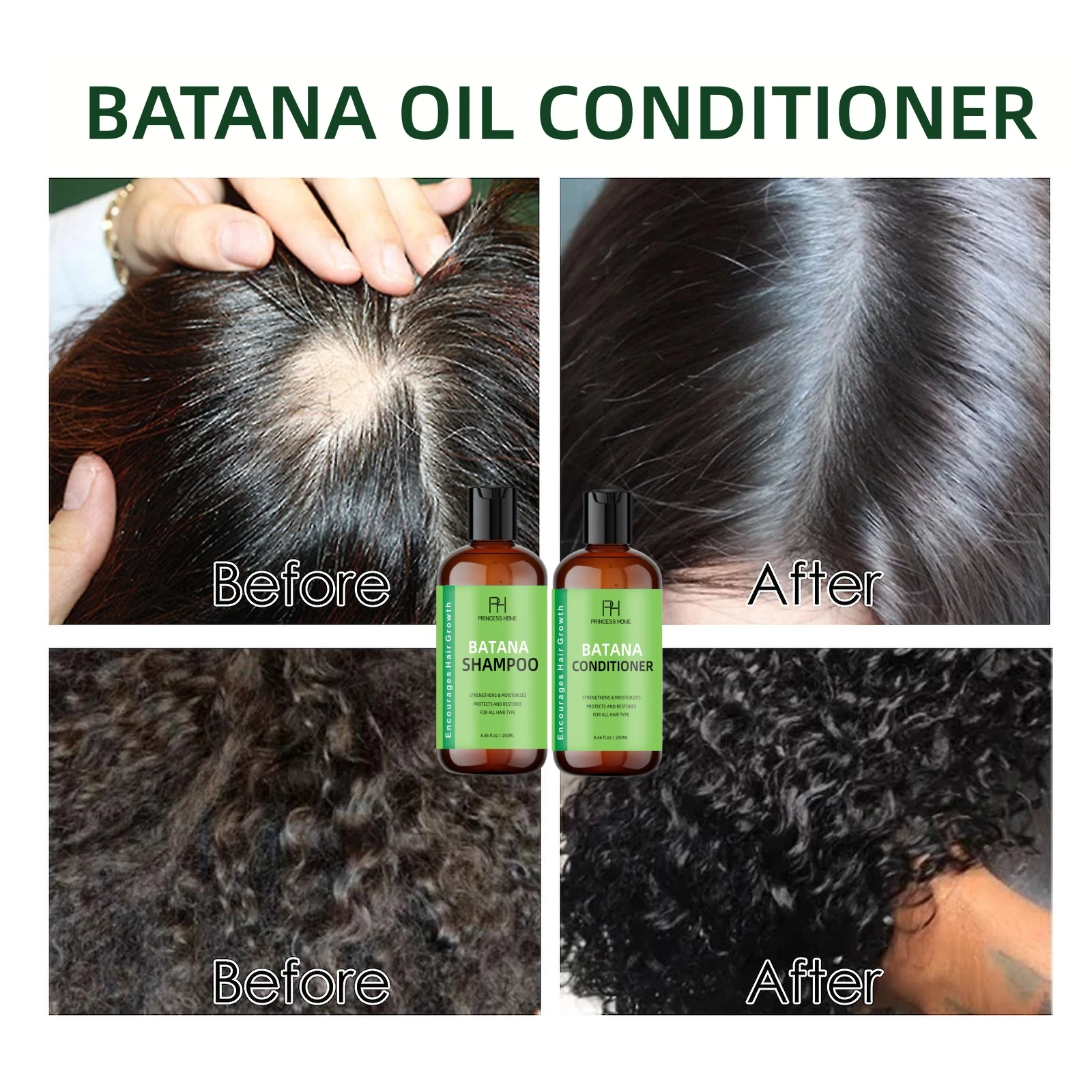 Sulfate Free Hair Loss Shampoo and Conditioner Raw Batana Oil Hair Growth Unrefined Promotes thickness Men & Women