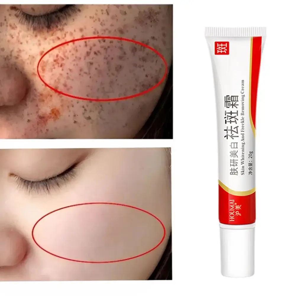 

Whitening Freckle Cream Remove Melasma Dark Sun Spots Lighten Anti-aging Moisturizing Brighten Rejuvenation Skin Care