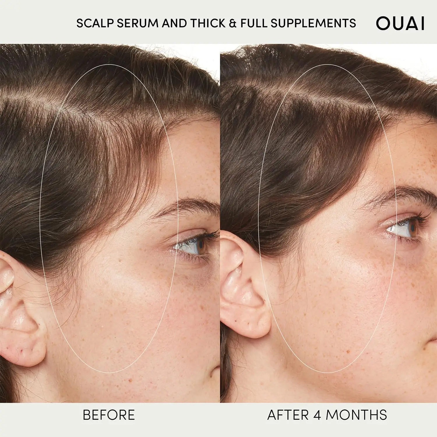OUAI Scalp Serum Balancing and Hydrating Serum with Red Clover Extract, Siberian Ginseng and Peptides for Thicker Fuller