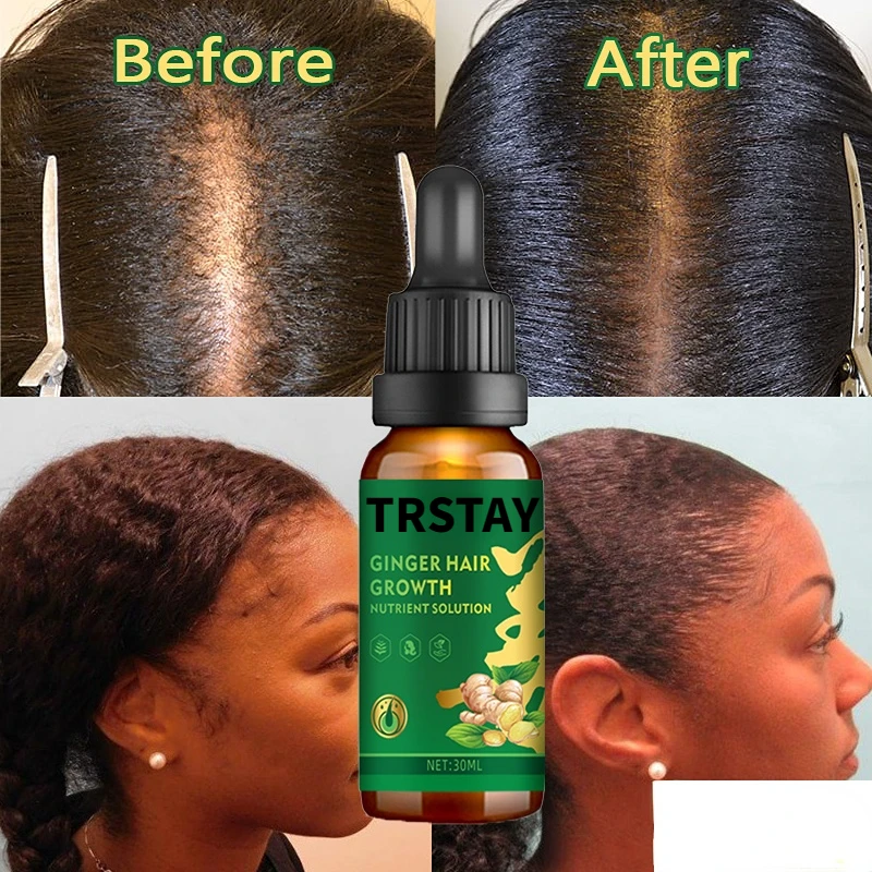 Black Women Hair Growth Oil Essential Oils Liquid Anti Hair Loss