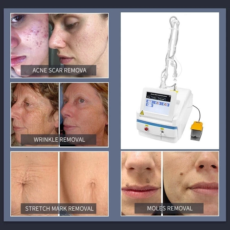 Рисунок 6 - Фракционный Лазерный Аппарат CO2