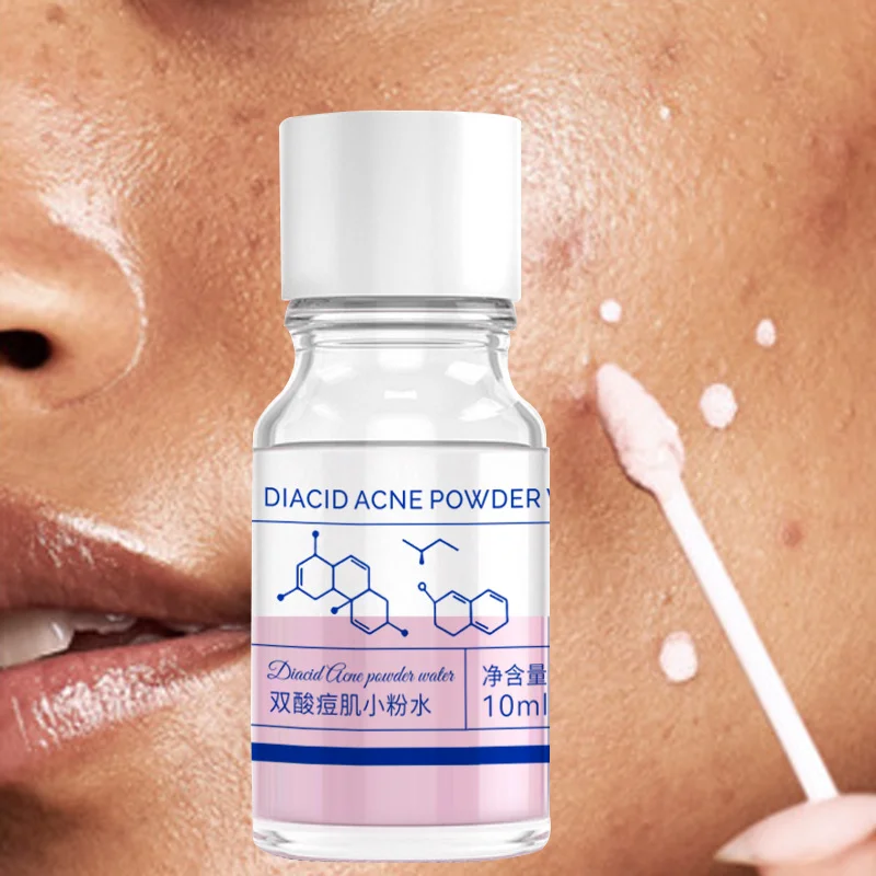 10ml salicylic acid concentrated acne essence containing salicylic acid lactose acid calamine double acid dual care