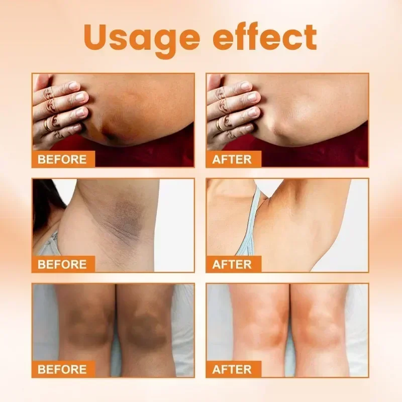 Vitamin C Brighten Cream Brightening Skin Cream Moisturizing Body Lotion Cream Lightening Melanin Bleaching Armpits Elbows Knees 5