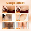 Vitamin C Brighten Cream Brightening Skin Cream Moisturizing Body Lotion Cream Lightening Melanin Bleaching Armpits Elbows Knees 5