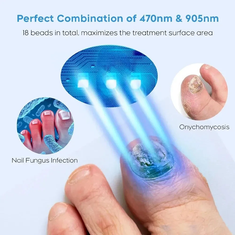 Nail Fungus Treatment Laser Device for Cleaning Onychomycosis Anti Fungal Repair Toenail Fingernail Foot Care Tools
