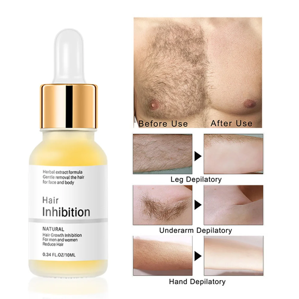 Gentle and painless hair removal Continuous suppression serum, painless removal agent legs, arms, growth inhibitors, hair_voghion.com