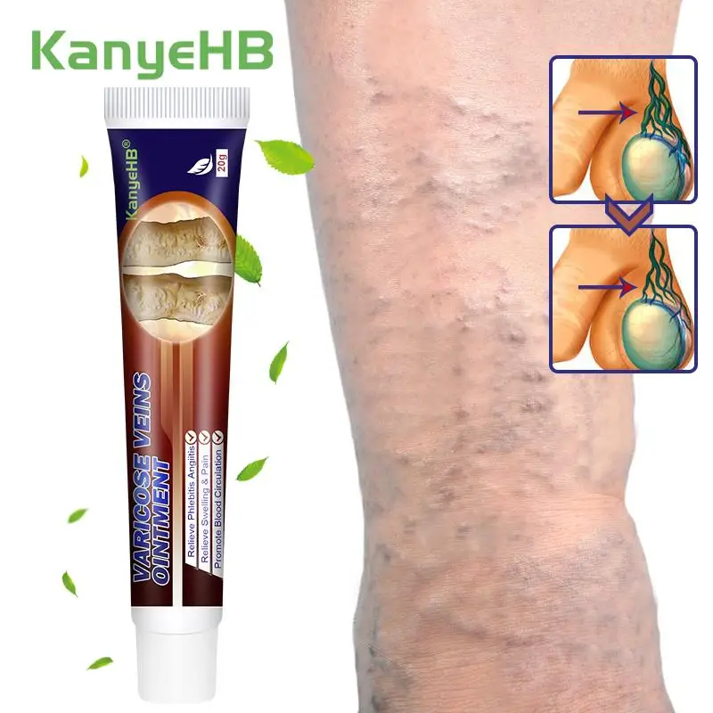 

1Pcs Varicose Vein Relieve Cream Varicocele Phlebitis Genital Vein Pain Swelling Ointment Body Care Herbal Medical Plaster G010