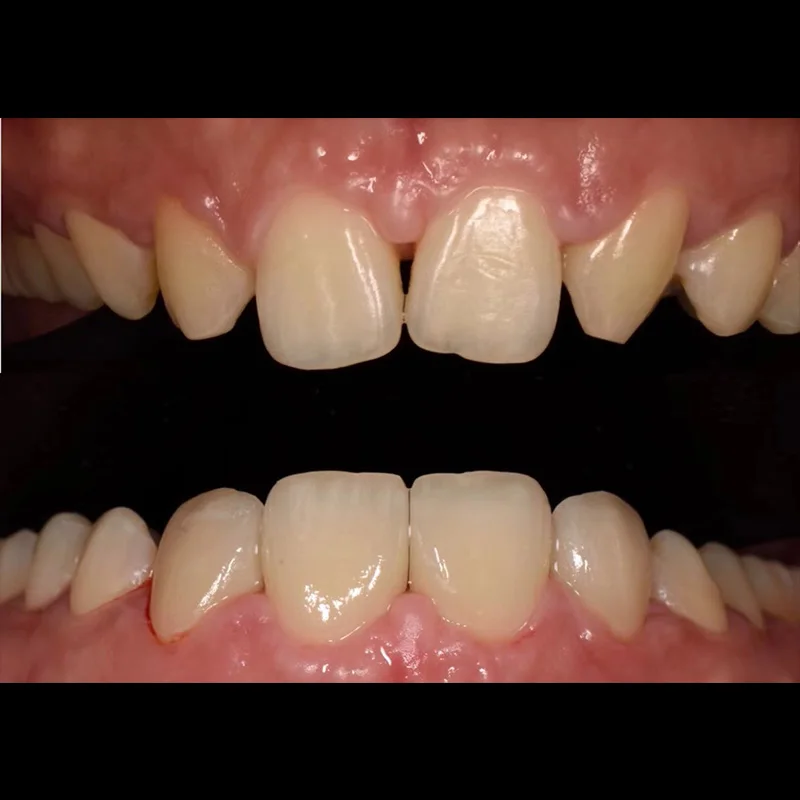 Рисунок 6 - Стоматологический лабораторный вакуумный насос