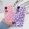 For Honor X7 6.74" Phone Case Fashion Leopard Print Back Cover Soft Silicone Shockproof Fundas For Honor x7 x 7 Coque Shell Bags 3