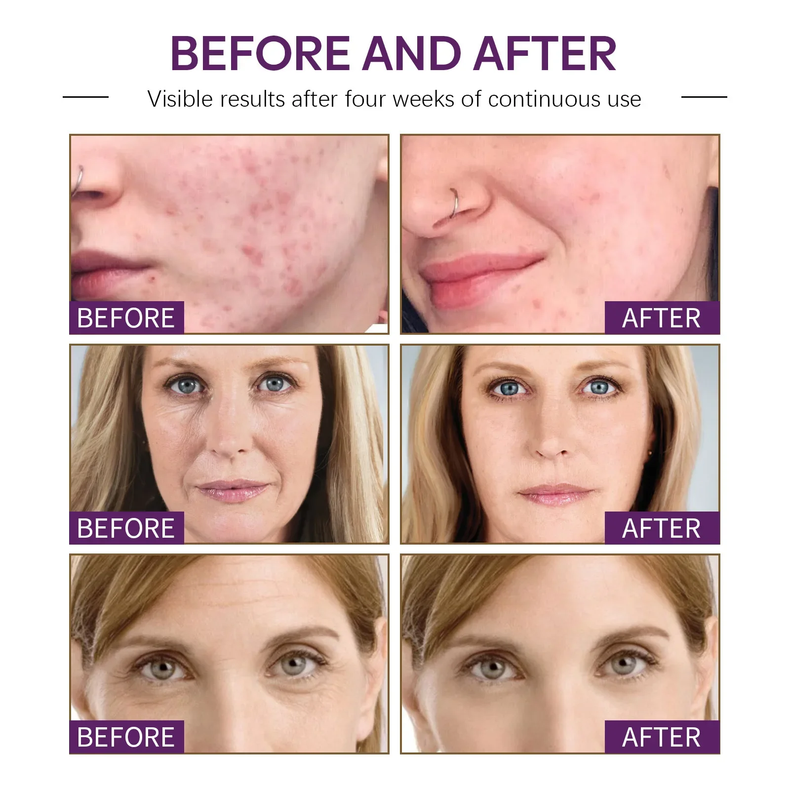 Crème Anti-âge réparatrice des coups de soleil, éclaircit les ridules, rétrécit les Pores, blanchissante, hydratante, crème papaye et safran_voghion.com