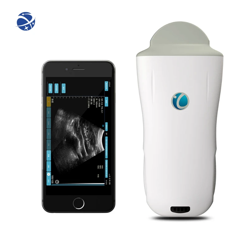 

Ультразвуковой сканер, ультразвуковая машина, беспроводной ручной ультразвук с Wi-Fi