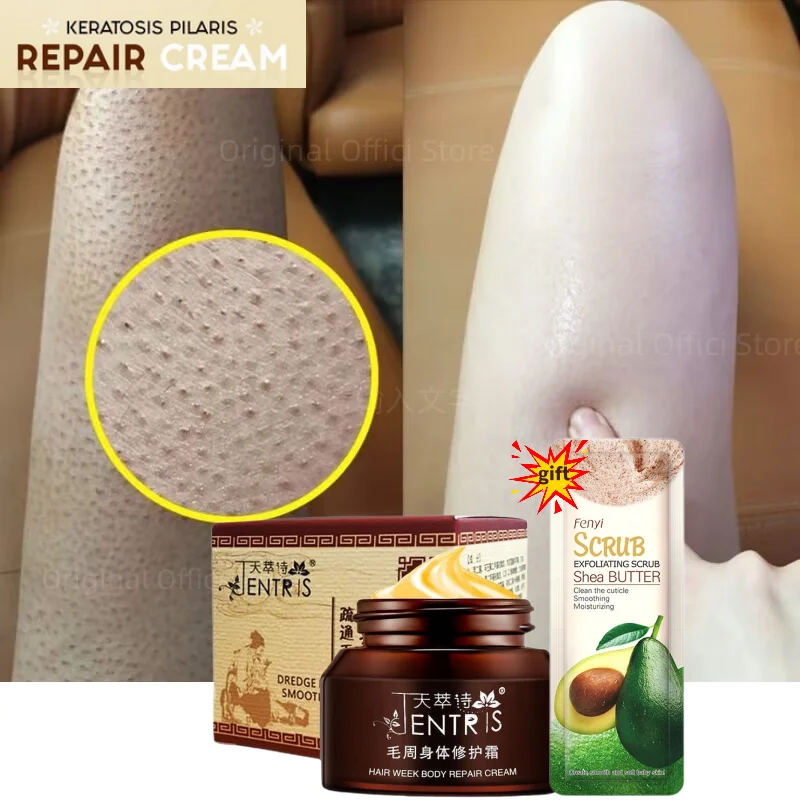 50g Curing Keratosis Pilaris Chicken Follicle Skin Repair Cream Body