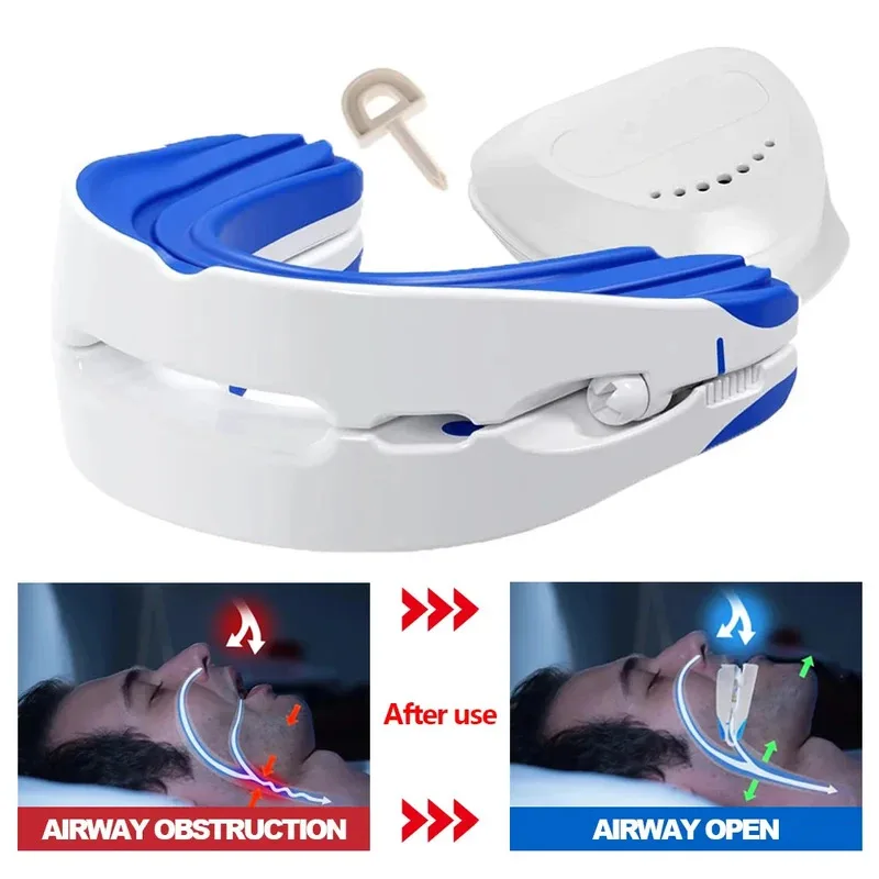 Anti-Snoring Mouthguard Anti-Snoring Device Nighttime Teeth Guard Adjustable Sleep Mouthguard for Bruxism