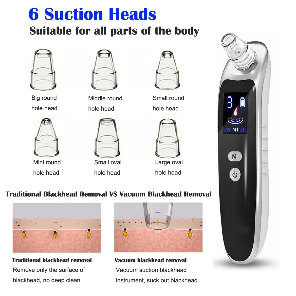 ZJM0001- Facial Blackhead and Acne Removal Cleaner Electric Blackhead Removal Tool Facial Vacuum Cleaner