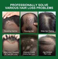 Fast Hair Growth Serum Spray Anti Hair Loss Prevent Baldness Scalp Treatment Repair Roots Beauty Health Hair Care For Men Women 4