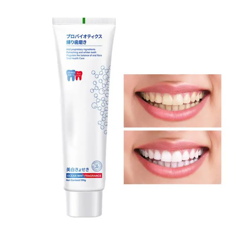 

Teeth Brightening Toothpaste 100g Brightening Dental Paste Mint Flavor Deep Cleansing For Stain Removal Toothpaste Teeth Whiter