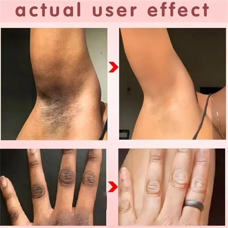 Body Whitening Soap Deep Clean Skin Chicken Skin Removal Armpit Underarm Knees Bleaching Body Brighten White Care Products skin whitening soap