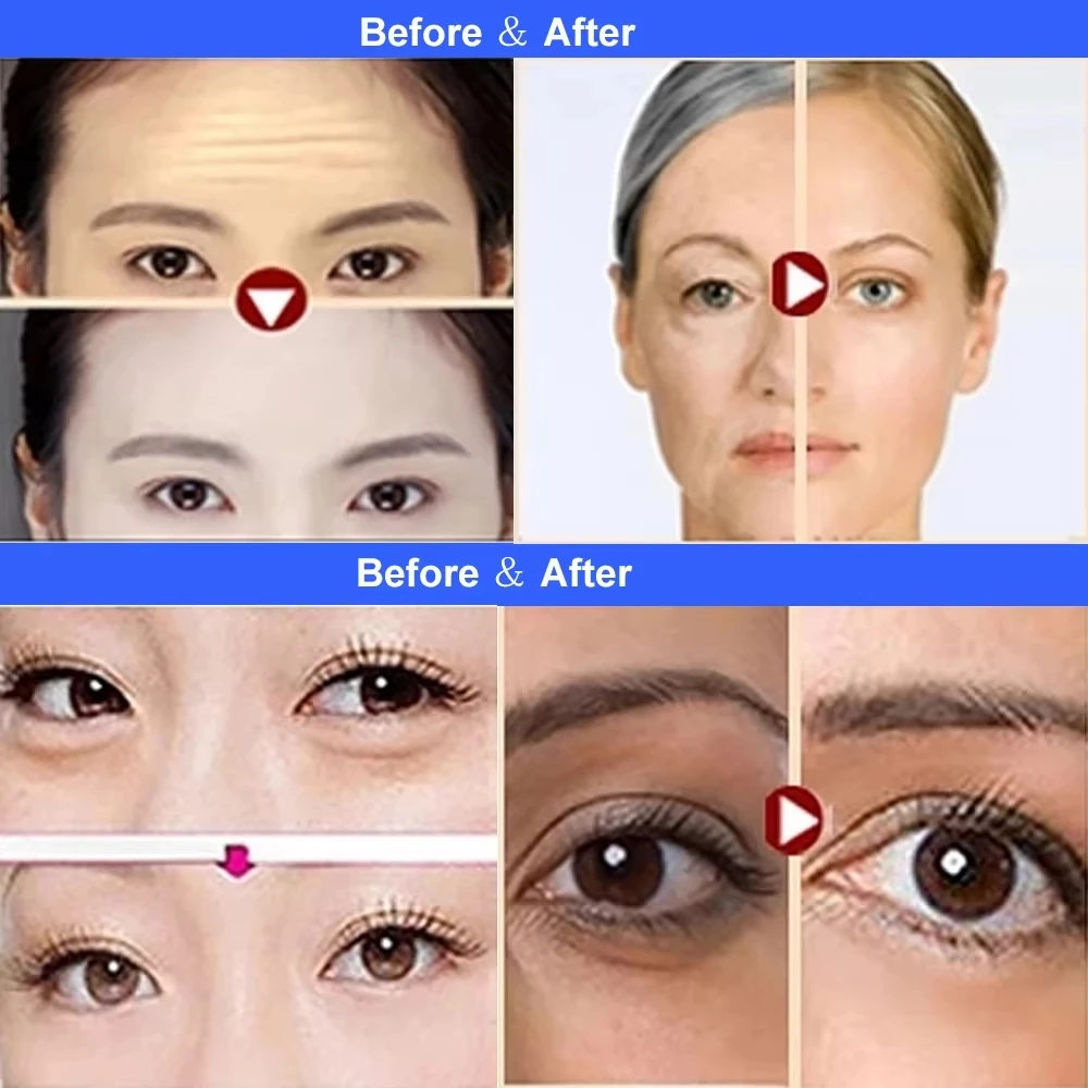 Latest Radio Frequency Monopolar RF Beauty Machine Face Lifting Wrinkle Removal Body Slimming Massager Device Skin Rejuvenation 6