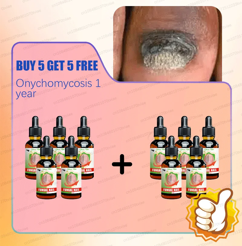 Description Picture 3 of itemEliminate nail problems