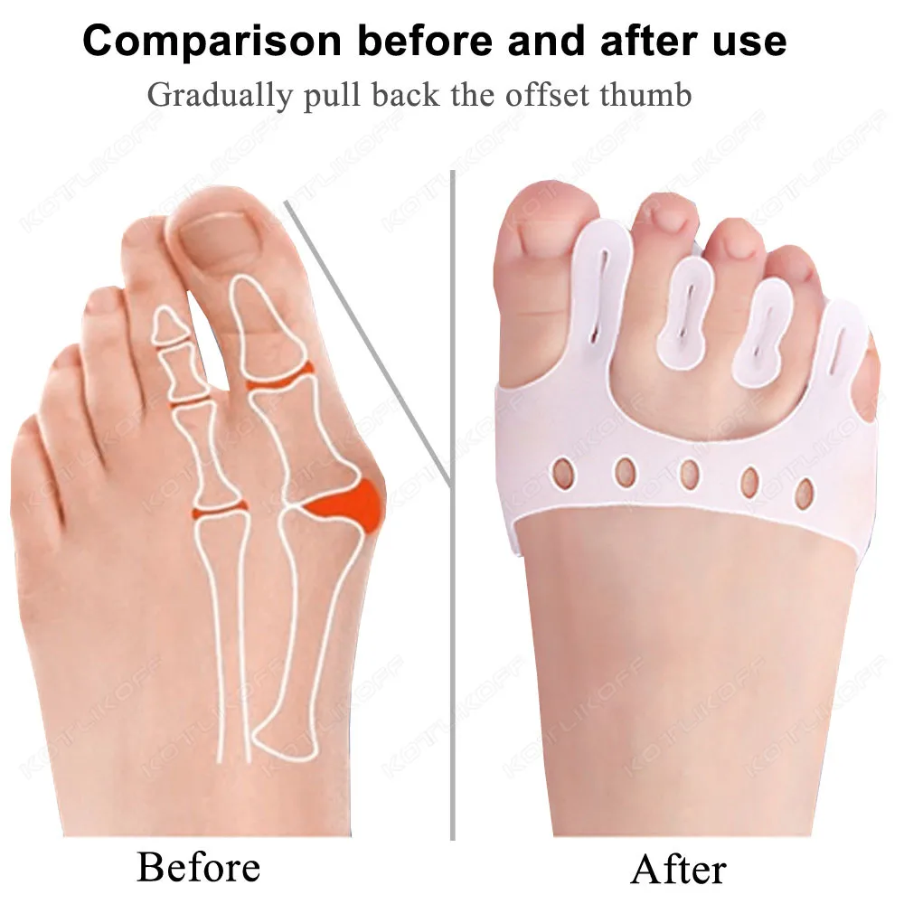 Five Toe Separator Hallux Valgus Corrector Thickened Forefoot Cushion Pressure Relief Massage Toe Overlap Corrector Pad Care