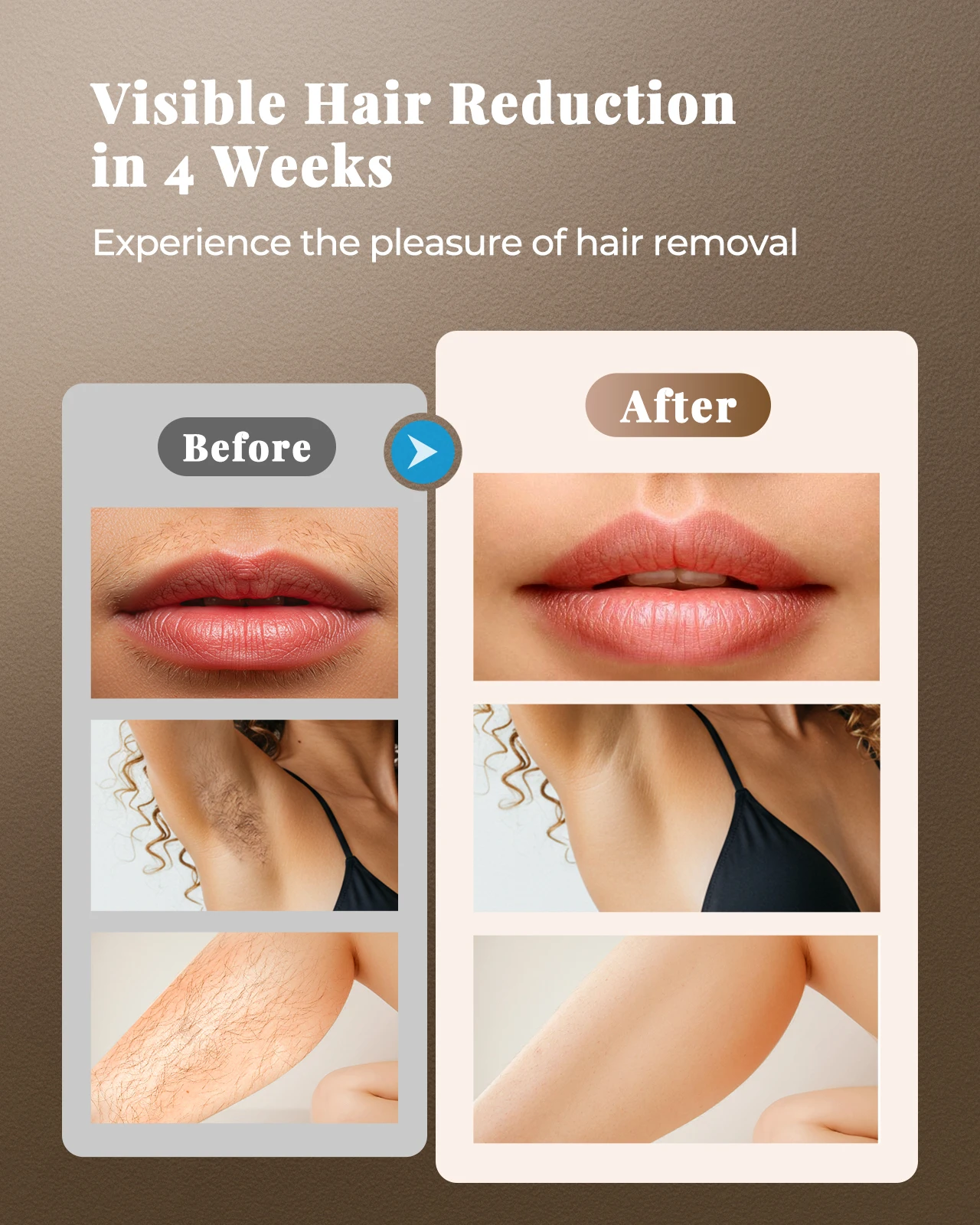Premium IPL Hair Removal Device | 999,900+ Flashes | 21J Professional Energy Benefits