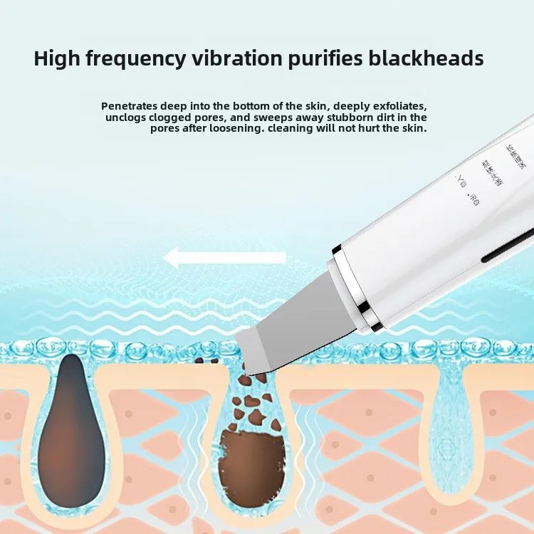 Ultrasonic Skin Scrubber Peeling Blackhead Remover Deep Face Cleaning Ultrasonic Ion Acne Pore Cleaner Facial Shovel Scrubber