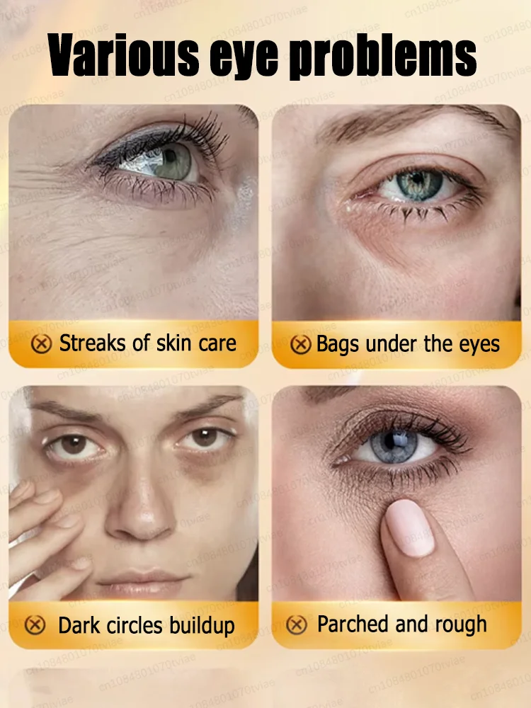 Eye bags remover eye bags are a thing of the past youth is still handsome
