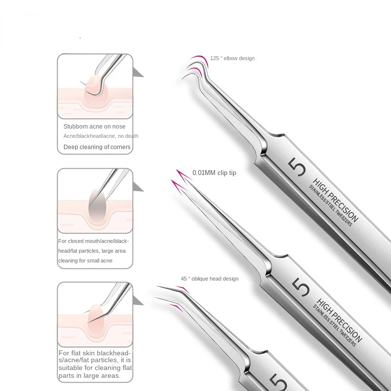 GermanUltrafineNo5CellPimplesBlackheadClipTweezersBeauty