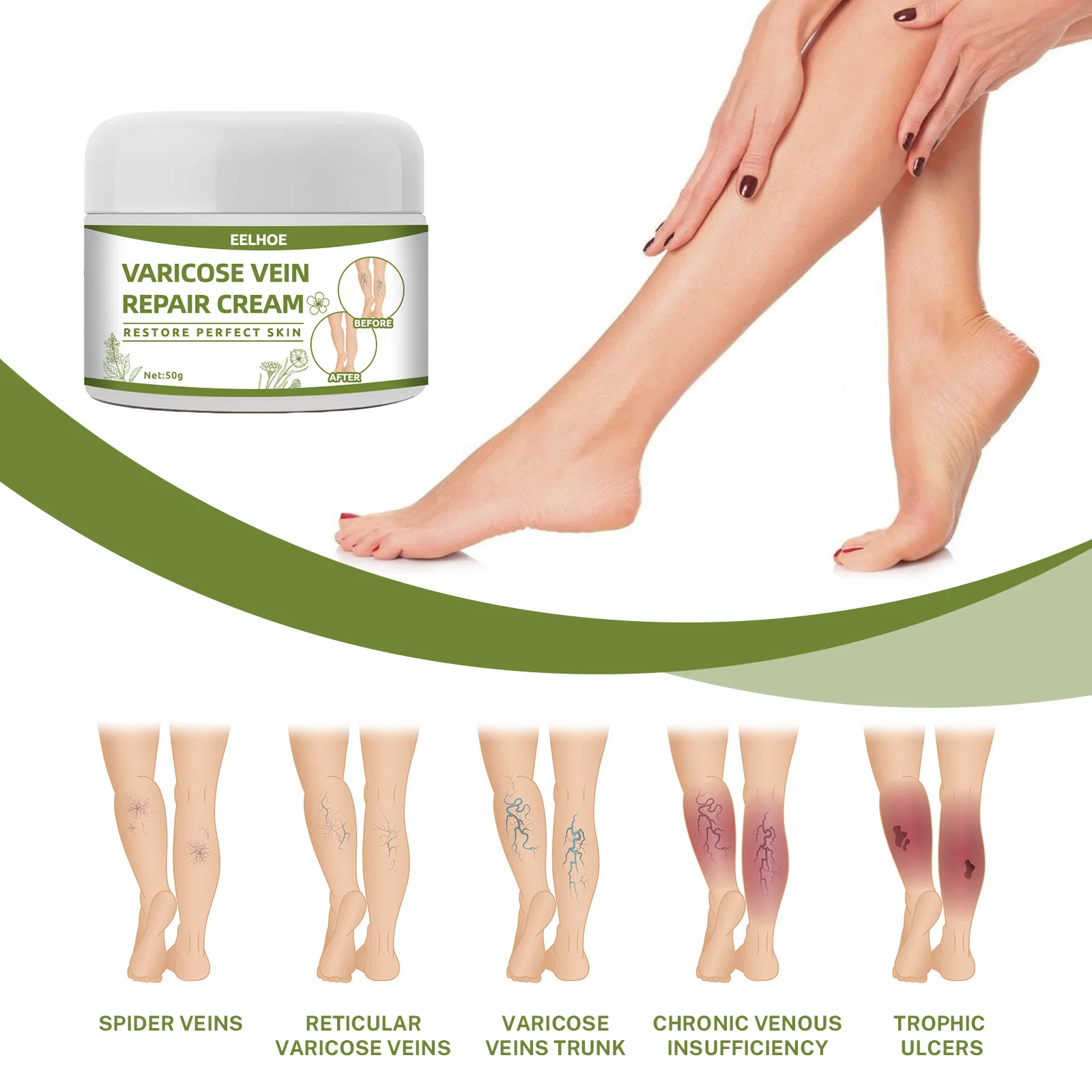 Veinsrepair Varicose Treatment Cream Spider Veins Repair Cream Varicose Veins Treatment Cream Relief Tired And Heavy Legs 50g Vein Leg Care Fading Creams Varicose Veins Repair Massage Cream Dredge Meridians
