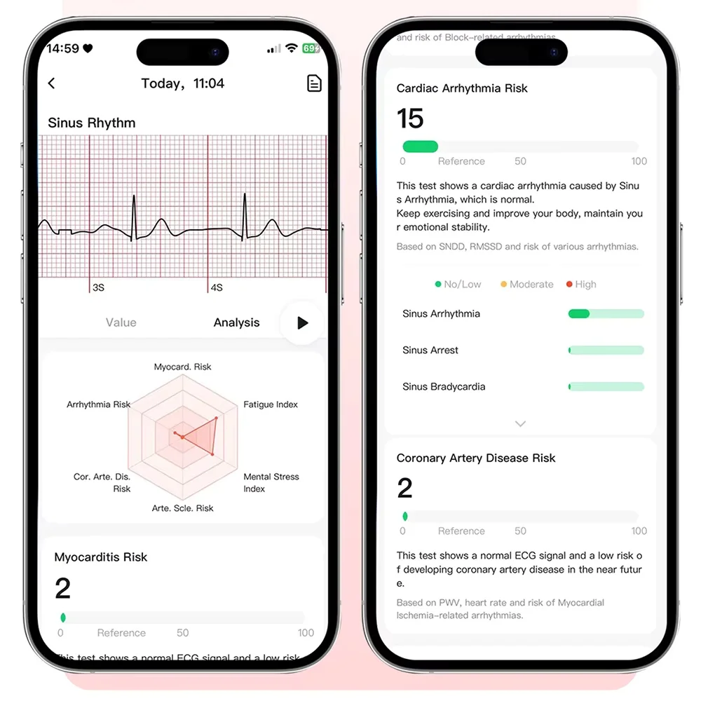 2026 New Accurate Measurement Health Smart Watch ECG+PPG Uric Acid Blood Pressure Blood Lipids BT CallSmartwatchs ForiOS Andr0id 6