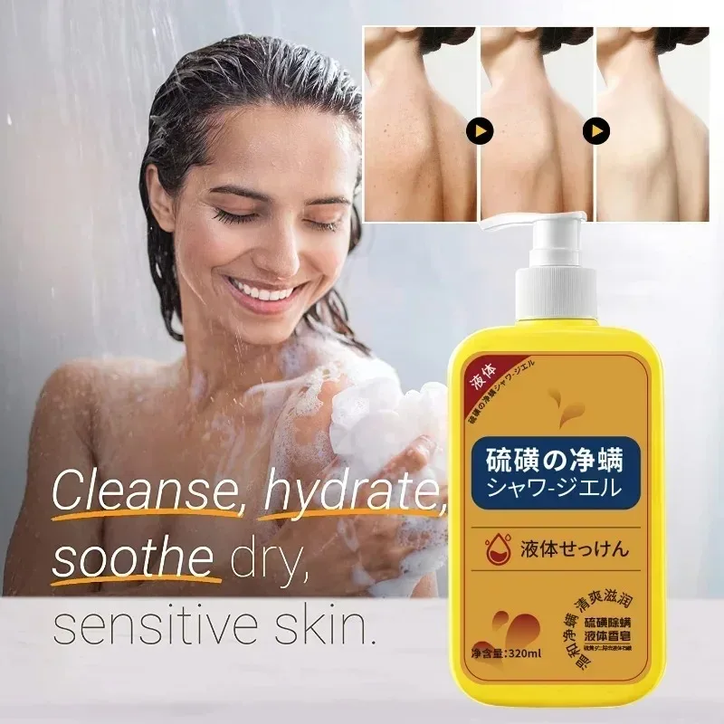 320ml Sulfur Liquid Mite Removal Soap-Deep Cleansing Shower Gel for Whole Body Acne Treatment-Body Wash for Deep Cleaning