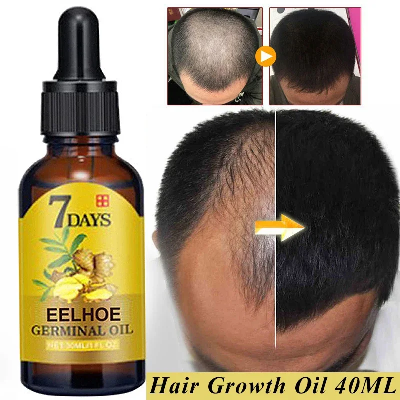 

Ginger Essential Hair Growth Oil Liquid Anti Hair Loss Baldness Remedy Boost Grow Thicker Hair Care Scalp Treatment Product 40ml