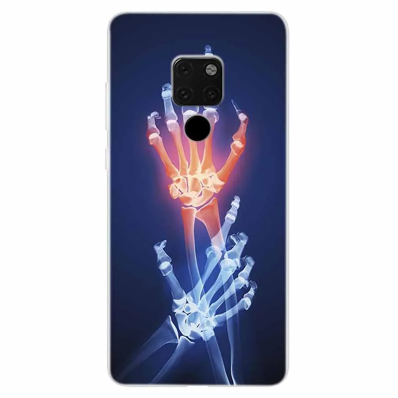 Clear TPU Soft Silicone Phone Case - Protective Back Cover