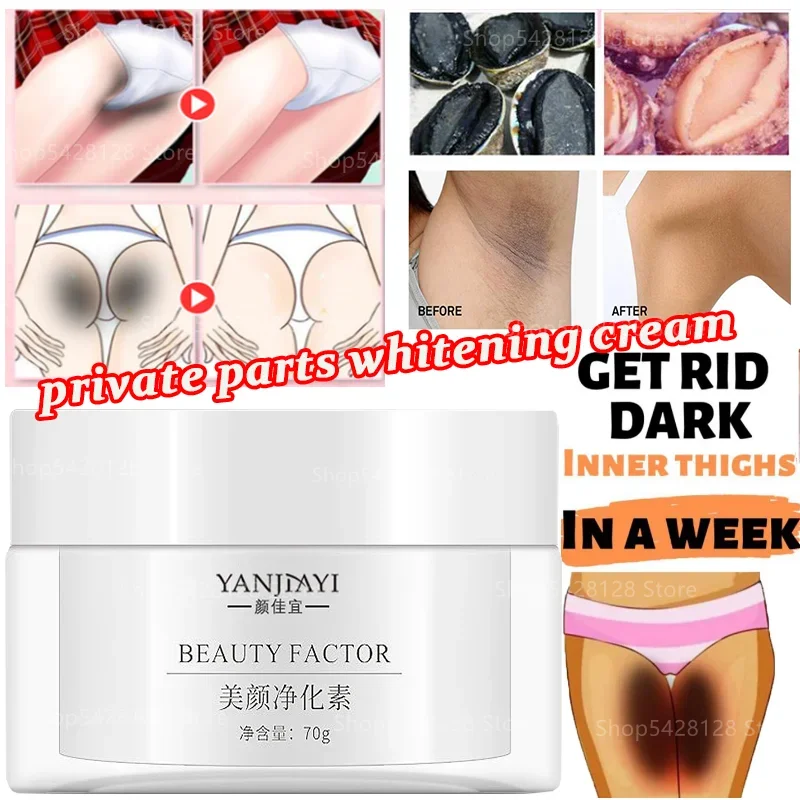 Private Parts Joint Armpit Melanin Deposition Body Whitening Cream, Unisex Private Parts Whitening Skin Cream Lightening Cream