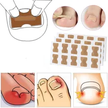 

10pcs Nail Correction Patch