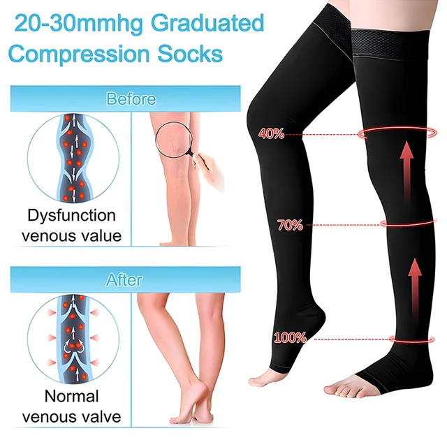 Thigh High Compression Stockings, Open Toe, Pair, Firm Support 20-30mmHg  Gradient Compression Socks with Silicone Band, Unisex, Opaque, Best for