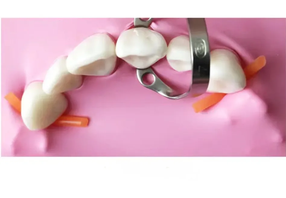 Dental Dam Rubber Dam Sheets Rubber Dam Clamps Barrier Clip Molar Premolar Carbon Fiber Dam Frame Dam Stabilizing Cord Dentistry – Detail 4