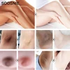 Intimate Whitening Cream Moisturizing Improve Dullness Lighten Dark Spots Improve Pigmentation Private Area Brighten 50g 4